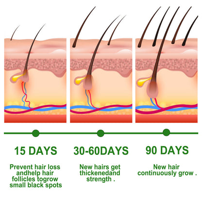 Rosemary Oil Blend - Hair Growth